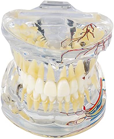 KH66ZKY Транспарентен Патолошки Модел На Заби-Модел На Забни Заби-Со Стоматолошки Нерв, Инкрустиран Корен Канал, За Прикажување